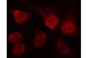 ABIN6274517 staining Hela cells by IF/ICC. (ARNT2 Antikörper  (N-Term))