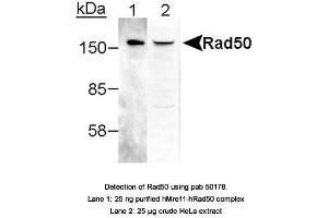 Image no. 1 for anti-RAD50 Homolog (S. Cerevisiae) (RAD50) antibody (ABIN363487) (RAD50 Antikörper)