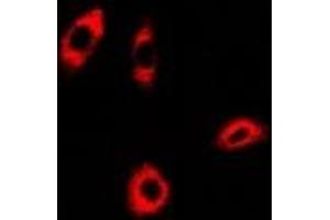 Immunofluorescent analysis of PHACS staining in A549 cells. (PHACS Antikörper)