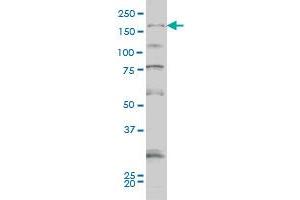 SYNJ1 monoclonal antibody (M01A), clone 1A2 Western Blot analysis of SYNJ1 expression in Hela S3 NE .