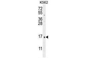 CALCA Antibody (Center) western blot analysis in K562 cell line lysates (35µg/lane).