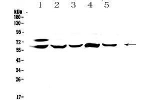 Western blot analysis of CES1 using anti-CES1 antibody . (CES1 Antikörper  (AA 99-206))
