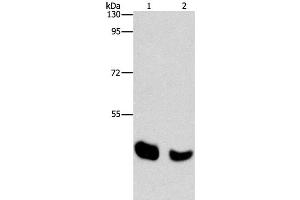 Western Blot analysis of Human normal liver and Mouse pancreas tissue using BAAT Polyclonal Antibody at dilution of 1:650 (BAAT Antikörper)