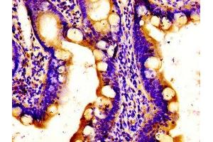 Immunohistochemistry of paraffin-embedded human small intestine tissue using ABIN7150152 at dilution of 1:100 (APOBEC3D Antikörper  (AA 250-371))