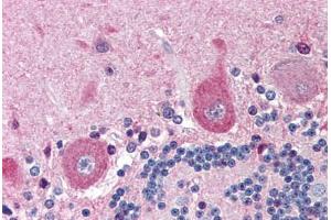 Human Brain, Cerebellum (formalin-fixed, paraffin-embedded) stained with NGFR antibody ABIN214454 at 5 ug/ml followed by biotinylated goat anti-rabbit IgG secondary antibody ABIN481713, alkaline phosphatase-streptavidin and chromogen. (NGFR Antikörper)