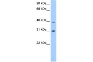 Western Blotting (WB) image for anti-Eukaryotic Translation Initiation Factor 3 Subunit H (EIF3H) antibody (ABIN2463339) (EIF3H Antikörper)