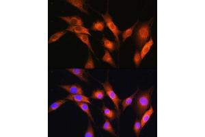 Immunofluorescence analysis of NIH/3T3 cells using  Rabbit pAb (ABIN7265658) at dilution of 1:100. (ARCN1 Antikörper  (AA 212-511))