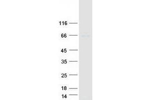 Western Blotting (WB) image for Signal Transducing Adaptor Molecule (SH3 Domain and ITAM Motif) 1 (STAM) protein (Myc-DYKDDDDK Tag) (ABIN2732750)