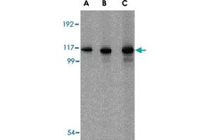 Western blot analysis of IFIH1 in Daudi cell lysate with IFIH1 polyclonal antibody  at (A) 1, (B) 2 and (C) 4 ug/mL . (IFIH1 Antikörper  (C-Term))