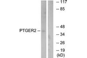 Western blot analysis of extracts from HeLa cells, using PTGER2 Antibody. (PTGER2 Antikörper  (AA 260-309))