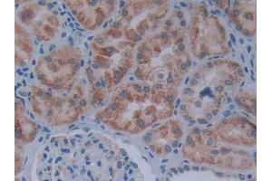DAB staining on IHC-P; Samples: Human Kidney Tissue (SIVA1 Antikörper  (AA 1-175))