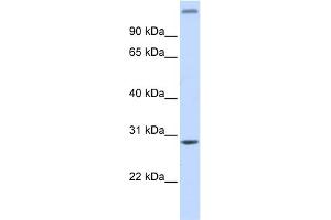 WB Suggested Anti-ALKBH2 Antibody Titration: 0.