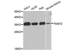Western blot analysis of extracts of various cell lines, using TNNT2 antibody. (Cardiac Troponin T2 Antikörper  (AA 1-120))