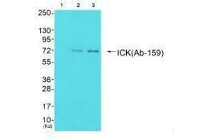 Western blot analysis of extracts from 293 cells (Lane 2) and cos-7 cells (Lane 3), using ICK (Ab-159) antiobdy. (ICK Antikörper  (Tyr159))