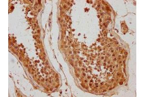 IHC image of ABIN7175810 diluted at 1:500 and staining in paraffin-embedded human testis tissue performed on a Leica BondTM system.