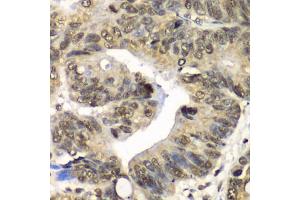 Immunohistochemistry of paraffin-embedded human colon using UFD1L antibody (ABIN6291036) at dilution of 1:100 (40x lens). (UFD1L Antikörper)