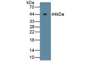 Detection of Recombinant C9, Rabbit using Polyclonal Antibody to Complement Component 9 (C9) (C9 Antikörper  (AA 139-519))