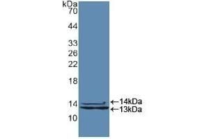 Detection of Recombinant HNRPA2B1, Human using Polyclonal Antibody to Heterogeneous Nuclear Ribonucleoprotein A2/B1 (HNRPA2B1) (HNRNPA2B1 Antikörper  (AA 21-103))