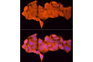 Immunofluorescence analysis of HeLa cells using PSMC5 Rabbit mAb (ABIN7269585) at dilution of 1:50 (40x lens). (PSMC5 Antikörper)