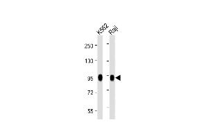 Western Blotting (WB) image for anti-Small Nuclear Ribonucleoprotein Polypeptide E (SNRPE) (AA 424-453) antibody (ABIN392249)