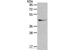 Western blot analysis of A549 cell, using GRPR Polyclonal Antibody at dilution of 1:333 (GRPR Antikörper)