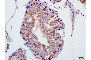 Formalin-fixed and paraffin embedded rat testis labeled with Anti-TXNRD1 Polyclonal Antibody, Unconjugated (ABIN1386102) at 1:200 followed by conjugation to the secondary antibody and DAB staining (TXNRD1 Antikörper  (AA 451-550))