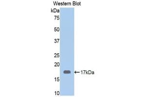 Detection of Recombinant CALR, Human using Polyclonal Antibody to Calreticulin (CALR) (Calreticulin Antikörper  (AA 196-310))