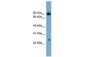 SLC6A5 antibody used at 1 ug/ml to detect target protein. (SLC6A5 Antikörper)