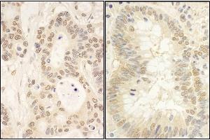 Immunohistochemistry (IHC) image for anti-Fas (TNFRSF6) Associated Factor 1 (FAF1) (AA 550-600) antibody (ABIN7454469)