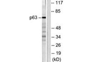 Western blot analysis of extracts from COS7 cells, using p63 Antibody. (TCP1 alpha/CCTA Antikörper  (AA 631-680))