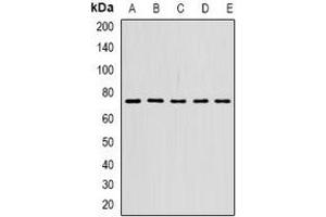 Western blot analysis of STS-1 expression in SW620 (A), SKOV3 (B), mouse spleen (C), mouse lung (D), rat brain (E) whole cell lysates.