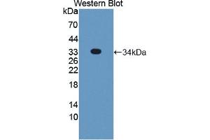 Detection of Recombinant STX2, Human using Polyclonal Antibody to Syntaxin 2 (STX2) (STX2 Antikörper  (AA 8-262))