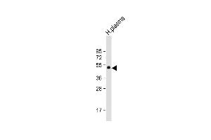Anti-PROC Antibody at 1:1000 dilution + H. (PROC Antikörper)