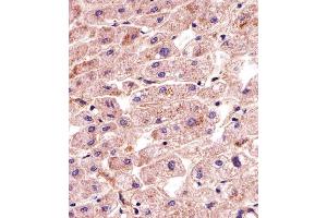 Immunohistochemical analysis of paraffin-embedded H. (MATN2 Antikörper  (AA 732-760))