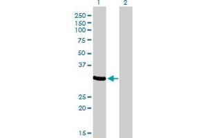 Western Blot analysis of ZNF215 expression in transfected 293T cell line by ZNF215 monoclonal antibody (M01), clone 2C11. (ZNF215 Antikörper  (AA 1-304))
