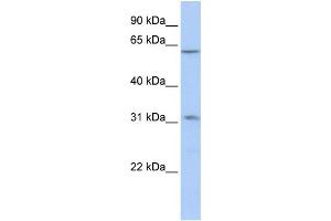 WB Suggested Anti-ZNF677 Antibody Titration:  0. (ZNF677 Antikörper  (C-Term))