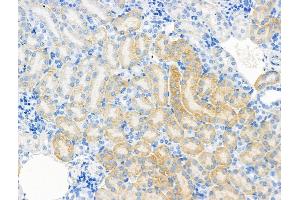 ABIN7094553 and ABIN7098602 at 1/100 staining Mouse kidney tissue by IHC-P.