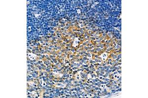 Immunohistochemistry of paraffin embedded mouse lymph node using CD39L4 (ABIN7073800) at dilution of 1:650 (460x lens) (ENTPD5 Antikörper)