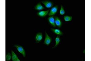 Immunofluorescence staining of A549 cells with ABIN7143827 at 1:66, counter-stained with DAPI. (alpha Actinin 4 Antikörper  (AA 160-440))