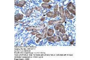 Human kidney (TRIM31 Antikörper  (N-Term))