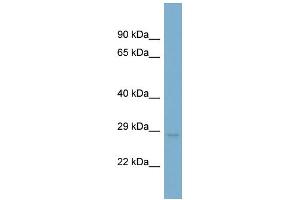 WB Suggested Anti-UQCRFS1 Antibody Titration: 0. (UQCRFS1 Antikörper  (N-Term))