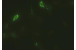 Anti-EpCAM mouse monoclonal antibody (ABIN2452362) immunofluorescent staining of HeLa cells transiently transfected by pCMV6-ENTRY EpCAM (RC201989) (EpCAM Antikörper  (AA 24-265))