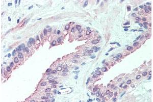 Anti-SLITRK6 antibody  ABIN960816 IHC staining of human prostate. (SLITRK6 Antikörper  (Internal Region))