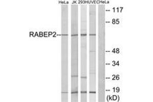 Western blot analysis of extracts from HeLa/Jurkat/293/HuvEc cells, using RABEP2 Antibody. (RABEP2 Antikörper  (AA 353-402))