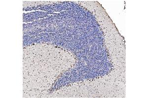 IHC analysis of SHANK3 using anti SHANK3 antibody (ABIN7600006).