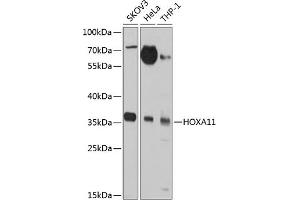 Western blot analysis of extracts of various cell lines, using HOX antibody (ABIN3017106, ABIN3017107, ABIN1680330 and ABIN6219956) at 1:1000 dilution. (Homeobox A11 Antikörper  (AA 1-180))