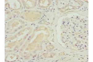 Immunohistochemistry (IHC) image for anti-Solute Carrier Family 12 (Potassium-Chloride Transporter) Member 6 (SLC12A6) (AA 60-190) antibody (ABIN7170087)