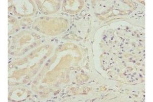 Immunohistochemistry of paraffin-embedded human kidney tissue using ABIN7170087 at dilution of 1:100 (SLC12A6 Antikörper  (AA 60-190))