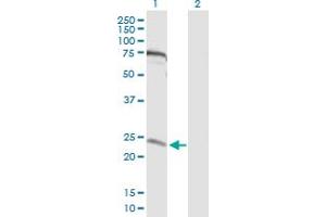 Western Blot analysis of MIS12 expression in transfected 293T cell line by MIS12 MaxPab polyclonal antibody. (MIS12 Antikörper  (AA 1-205))