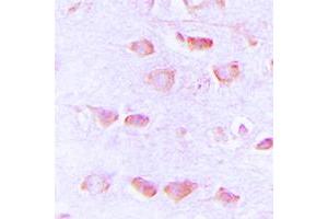 Immunohistochemical analysis of Histamine H3 Receptor staining in human brain formalin fixed paraffin embedded tissue section.